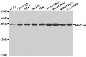 Western blot analysis of extracts of various cell lines, using NDUFV2 antibody. (NDUFV2 antibody  (AA 1-249))