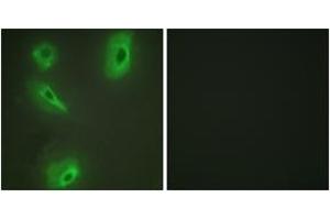 Immunofluorescence analysis of HeLa cells, using BCKD Antibody . (BCKDK antibody  (AA 11-60))