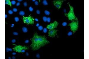 Anti-KATNB1 mouse monoclonal antibody (ABIN2455185) immunofluorescent staining of COS7 cells transiently transfected by pCMV6-ENTRY KATNB1 (RC201852). (KATNB1 antibody)