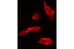 ABIN6267682 staining HT29 by IF/ICC. (CPI-17 antibody  (pThr38))