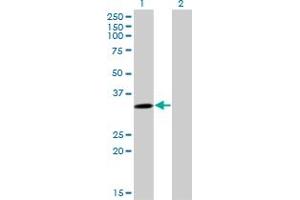SULT4A1 antibody  (AA 1-100)