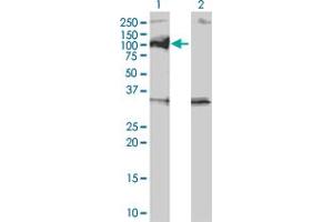 Western Blot analysis of PPM1D expression in transfected 293T cell line by PPM1D monoclonal antibody (M01), clone 4D1. (PPM1D antibody  (AA 496-605))