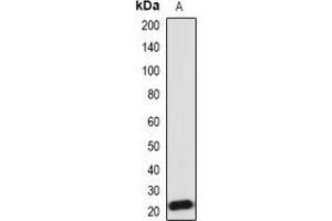 Western blot analysis of IL-18 expression in Hela (A) whole cell lysates. (IL-18 antibody)