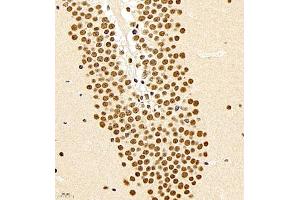 Immunohistochemistry of paraffin embedded mouse brain using smad62024 (ABIN7075629) at dilution of 1:1000 (400x lens) (SMAD6 antibody)
