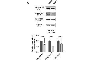 Integrin beta 3 antibody  (AA 27-120)