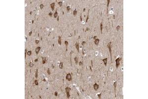 Immunohistochemical staining of human hippocampus with AADACL1 polyclonal antibody  shows strong cytoplasmic positivity in neuronal cells. (NCEH1 antibody)