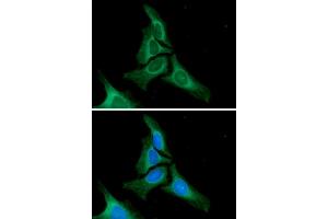ICC/IF analysis of Calnexin in HeLa cells. (Calnexin antibody  (AA 21-481))