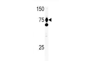 HGF antibody  (C-Term)