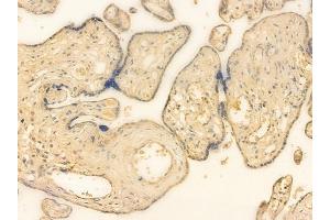ABIN6262161 and ABIN6266557 at 1/100 staining human normal placenta tissue by IHC-P. (HCG beta antibody  (Internal Region))