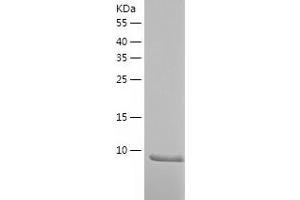 Western Blotting (WB) image for Secretoglobin, Family 1D, Member 1 (SCGB1D1) (AA 22-90) protein (His tag) (ABIN7284776) (SCGB1D1 Protein (AA 22-90) (His tag))