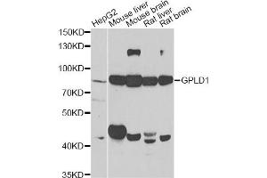Western blot analysis of extracts of various cell lines, using GPLD1 antibody (ABIN2562895) at 1:1000 dilution. (GPLD1 antibody)