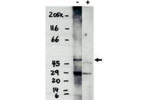 Image no. 1 for anti-Sphingosine-1-Phosphate Receptor 4 (S1PR4) (C-Term) antibody (ABIN201606) (S1PR4 antibody  (C-Term))