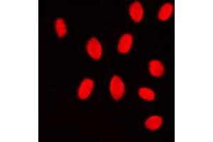Immunofluorescent analysis of MKK3/6 staining in Jurkat cells. (MKK3/6 (Center) antibody)
