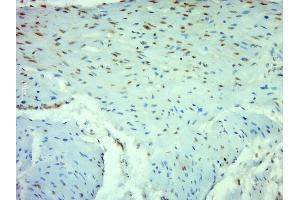 Immunohistochemistry (Paraffin-embedded Sections) (IHC (p)) image for anti-Nuclear Factor-kB p65 (NFkBP65) (AA 51-100) antibody (ABIN668961)