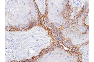 IHC-P Image Immunohistochemical analysis of paraffin-embedded SCC15 xenograft, using CD98, antibody at 1:100 dilution.