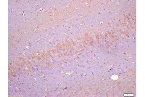 Formalin-fixed and paraffin embedded rat brain labeled with Anti-Cyclin F Polyclonal Antibody, Unconjugated (ABIN732968) at 1:200 followed by conjugation to the secondary antibody and DAB staining (Cyclin F antibody  (AA 451-550))