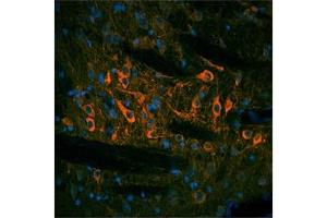rat and mouse brain (TH antibody  (N-Term))