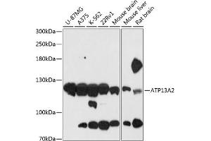 Western blot analysis of extracts of various cell lines, using  antibody (ABIN6127385, ABIN6137296, ABIN6137297 and ABIN6216941) at 1:3000 dilution. (ATP13A2 antibody  (AA 67-210))