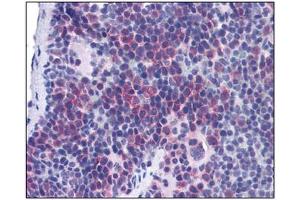 Image no. 1 for anti-T-Cell Immunoglobulin and Mucin Domain Containing 4 (TIMD4) (Center) antibody (ABIN302874) (TIMD4 antibody  (Center))