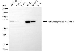 Western blotting analysis using natriuretic peptide receptor 3 antibody (ABIN7797702). (Recombinant NPR3 antibody)