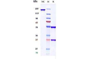 Anti-ALCAM / CD166 Reference Antibody (praluzatamab) on SDS-PAGE under reducing (R) condition. (Recombinant ALCAM (Praluzatamab Biosimilar) antibody)