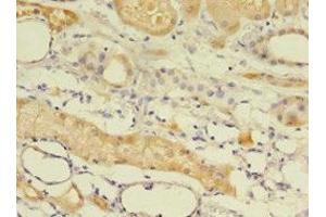 Immunohistochemistry of paraffin-embedded human kidney tissue using ABIN7145562 at dilution of 1:100 (EPHX2 antibody  (AA 1-555))
