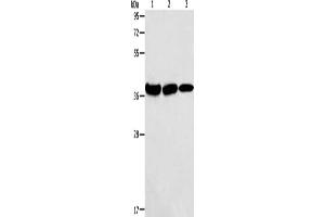 Gel: 10 % SDS-PAGE, Lysate: 40 μg, Lane 1-3: Mouse kidney tissue, human testis tissue, Human thyroid cancer tissue, Primary antibody: ABIN7128282(AGA Antibody) at dilution 1/100, Secondary antibody: Goat anti rabbit IgG at 1/8000 dilution, Exposure time: 10 seconds