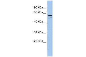 WB Suggested Anti-ZNF248 Antibody Titration:  0. (ZNF248 antibody  (N-Term))