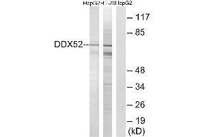 Western blot analysis of extracts from HepG2 cells and HT-29 cells, using DDX52 antibody. (DDX52 antibody  (C-Term))