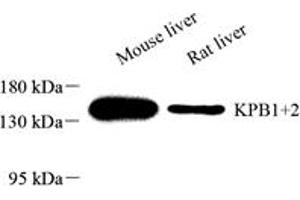 Western blot analysis of KPB1+2 (ABIN7074443) at dilution of 1: 2000,Lane 1: Mouse liver tissue lysate,Lane 2: Rat liver tissue lysate (KPB1/2 antibody)