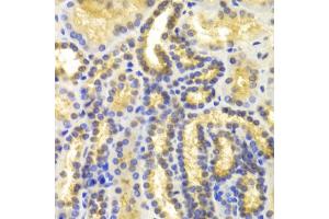 Immunohistochemistry of paraffin-embedded human kidney using EIF5A antibody (ABIN5971052) at dilution of 1/100 (40x lens). (EIF5A antibody)