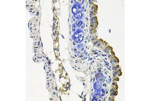 Immunohistochemistry of paraffin-embedded mouse lung using MARK1 antibody (ABIN5974592) at dilution of 1/100 (40x lens). (MARK1 antibody)
