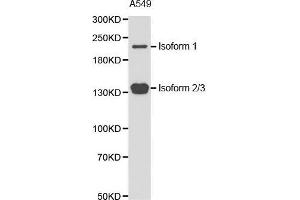 Western blot analysis of extracts of A549 cell line, using TET2 antibody. (TET2 antibody  (AA 1833-2002))