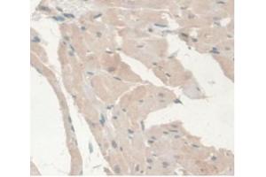 DAB staining on IHC-P Samples:Rat Heart Tissue (Androgen Receptor antibody  (AA 491-679))