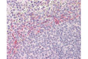 Human Spleen: Formalin-Fixed, Paraffin-Embedded (FFPE) (APOBEC3D antibody  (AA 61-74))