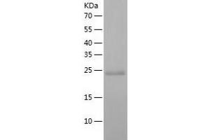 CLIC5 Protein (AA 1-236) (His tag)