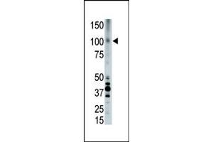 The anti-LRP8 Pab (ABIN390101 and ABIN2840613) is used in Western blot to detect LRP8 in placenta cell lysate. (LRP8 antibody  (C-Term))