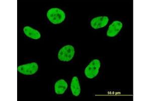 Image no. 3 for anti-Coiled-Coil Domain Containing 132 (CCDC132) (AA 862-965) antibody (ABIN961368) (Syndetin/VPS50 antibody  (AA 862-965))