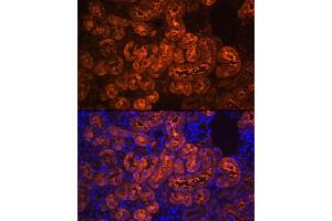 Immunofluorescence (IF) image for anti-phosphoenolpyruvate Carboxykinase 1 (Soluble) (PCK1) (C-Term) antibody (ABIN3022754)