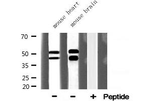 Western blot analysis of GSK3B expression in various lysates (GSK3 beta antibody  (N-Term))