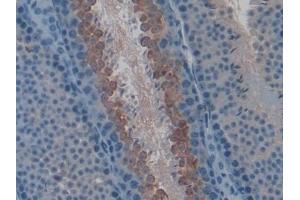 #VALUE! (LYAR antibody  (AA 270-388))