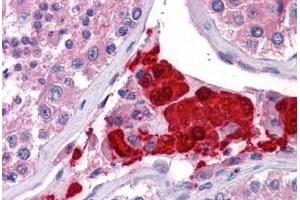Human Testis: Formalin-Fixed, Paraffin-Embedded (FFPE) (TTC1 antibody  (AA 193-293))