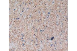 Used in DAB staining on fromalin fixed paraffin- embedded glioma tissue (Plexin A1 antibody  (AA 43-300))