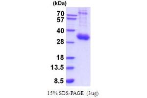 SDS-PAGE (SDS) image for Interleukin 10 Receptor, alpha (IL10RA) (AA 22-235) protein (His tag) (ABIN5854217)