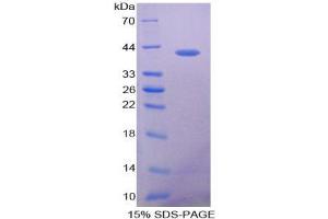 SDS-PAGE analysis of Human VCC1 Protein. (CXCL17 Protein)