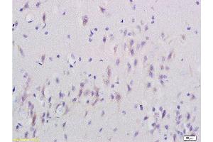 Formalin-fixed and paraffin embedded rat brain labeled with Anti-SNAP25 Polyclonal Antibody, Unconjugated  at 1:200 followed by conjugation to the secondary antibody and DAB staining.