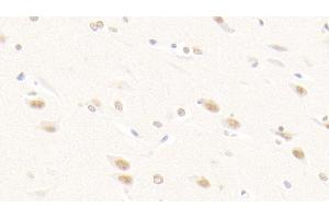 Detection of FGF2 in Human Cerebrum Tissue using Polyclonal Antibody to Fibroblast Growth Factor 2, Basic (FGF2) (FGF2 antibody  (AA 159-288))