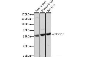 Western blot analysis of extracts of various cell lines using TP53I13 Polyclonal Antibody at dilution of 1:1000. (TP53I13 antibody)