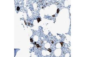 Immunohistochemical staining of human bone marrow with SLC22A15 polyclonal antibody  shows strong cytoplasmic positivity in megakaryocytes. (SLC22A15 antibody)