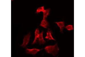ABIN6273837 staining HT29 by IF/ICC. (Serotonin Receptor 3A antibody  (Internal Region))